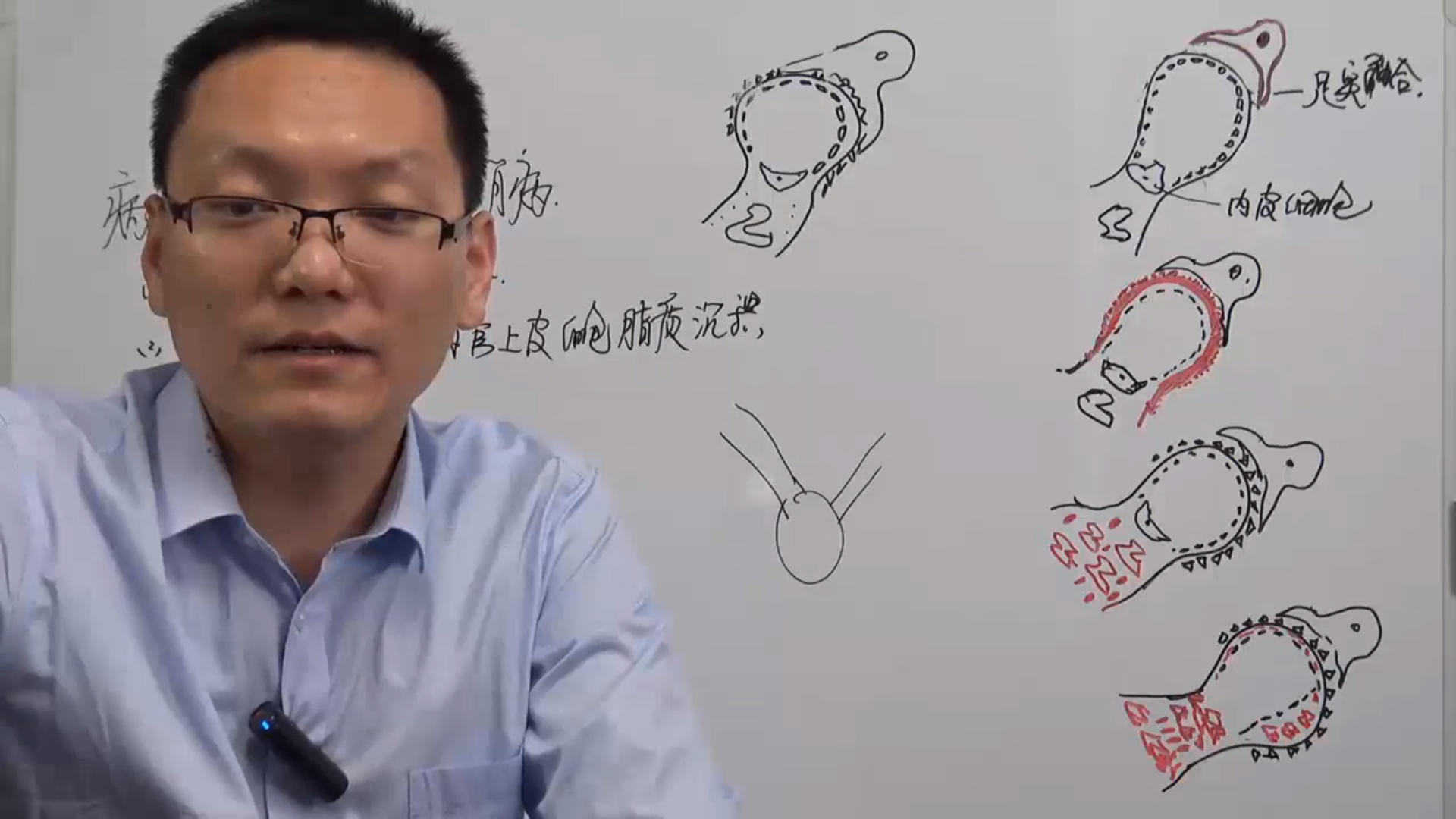 泌尿系统难点画图记忆-肾病总结